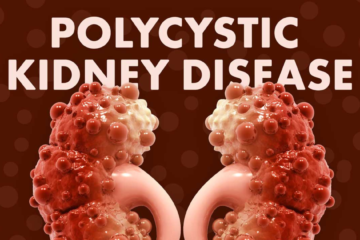 polycystic kidney disease