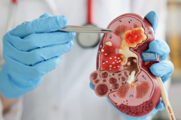 kidney transplant surgery