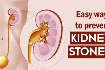 prevent kidney stones